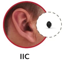 Invisible-in-Canal hearing aid shown in the ear